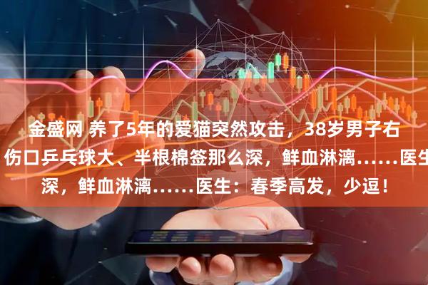 金盛网 养了5年的爱猫突然攻击，38岁男子右小腿被咬掉一块肉：伤口乒乓球大、半根棉签那么深，鲜血淋漓……医生：春季高发，少逗！